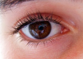 My eye