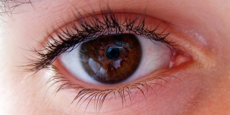 My eye