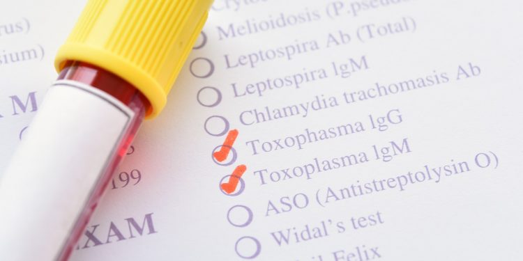 Blood sample for Toxoplasma test