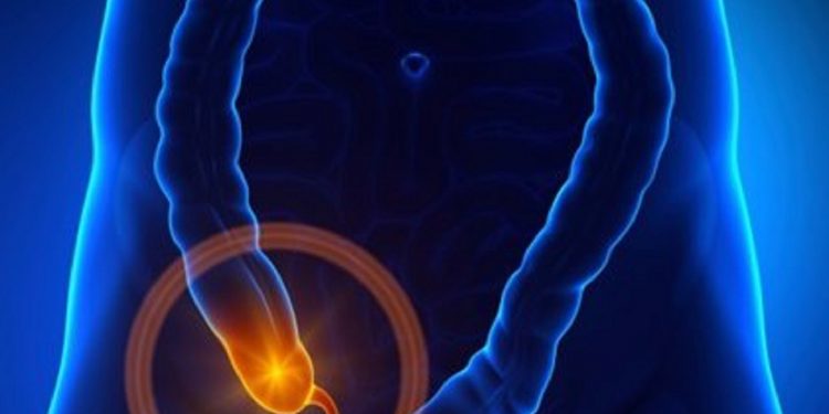 08/09/2014 Apéndice.
Investigadores del Nationwide Children's Hospital de Columbus, Estados Unidos, han demostrado que el tratamiento con antibióticos puede ser seguro y eficaz para curar un episodio de apendicitis aguda sin complicaciones en niños, lo que podría convertirse en una alternativa a la cirugía en estos casos.
ESPAÑA EUROPA MADRID SALUD
GETTY/DECADE3D