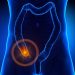08/09/2014 Apéndice.
Investigadores del Nationwide Children's Hospital de Columbus, Estados Unidos, han demostrado que el tratamiento con antibióticos puede ser seguro y eficaz para curar un episodio de apendicitis aguda sin complicaciones en niños, lo que podría convertirse en una alternativa a la cirugía en estos casos.
ESPAÑA EUROPA MADRID SALUD
GETTY/DECADE3D