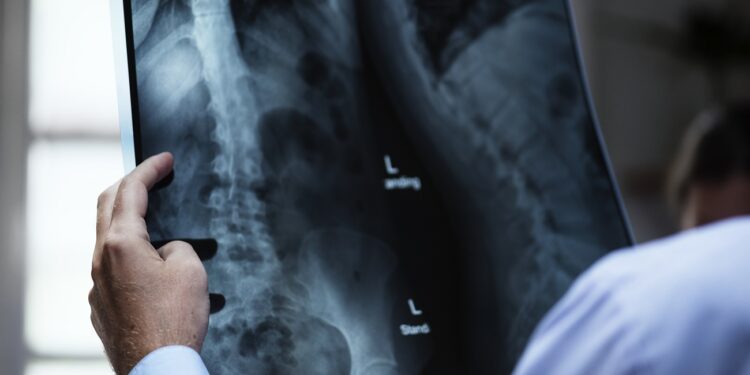 A doctor with a patient's x-ray film