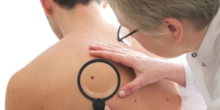 Dermatologist examines a mole of male patient