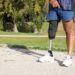 Close-up of Caucasian man with mechanical leg. Sportsman in blue shorts and white sneakers photographed in park. Sport, disability concept