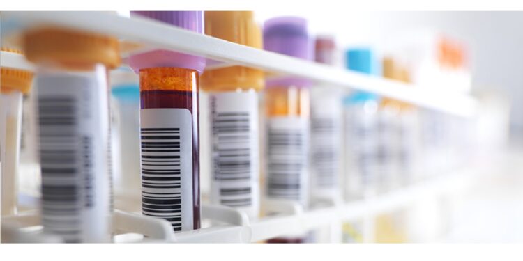 Blood samples in a test tube rack.