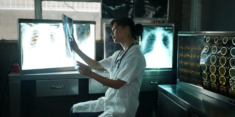 Doctor looking at x-ray image. Female medical doctor looking at x-rays in a hospital. Healthcare surgery diagnosis concept