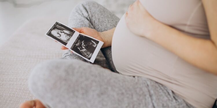 Pregnant woman with ultrasound photo sitting on bed
