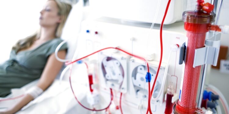 Kidney dialysis --- Image by © Science Photo Library/Corbis