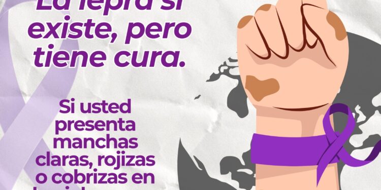 lepra (1)