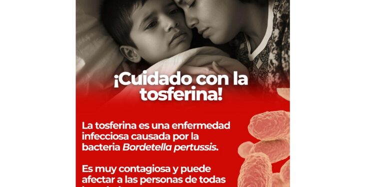 tosferina (2)