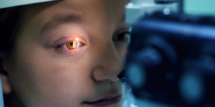 cornea 2