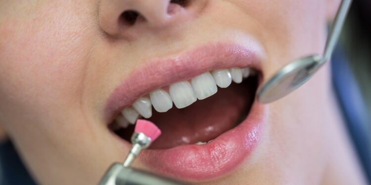 dentist examining a female patient with tools at dental clinic