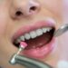dentist examining a female patient with tools at dental clinic