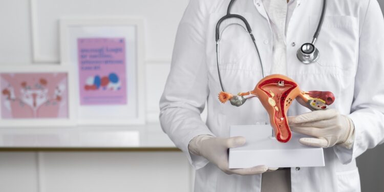endometriosis
