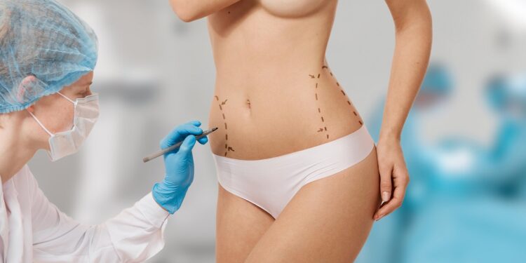 estetica