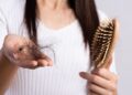 caida de cabello (1)