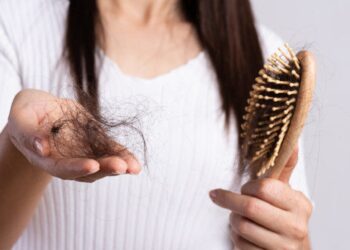 caida de cabello (1)