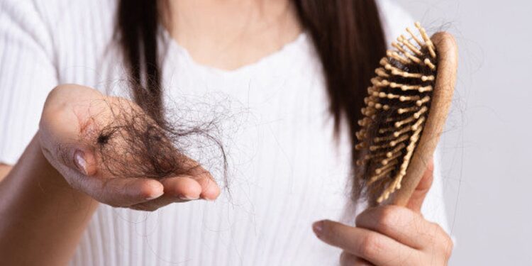 caida de cabello (1)