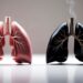 pulmones quemados